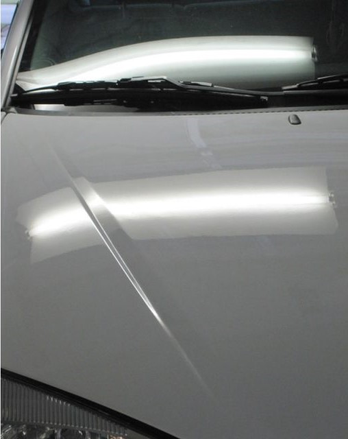 Kaput Göçük Düzeltme - Sonra